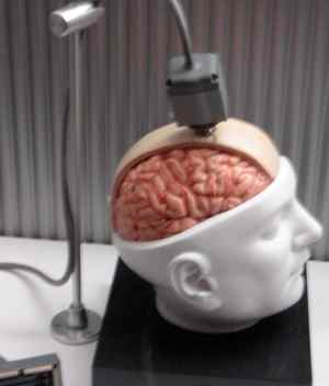 Brain interface